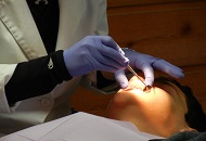 Cum se calculeaza pretul pentru o punte dentara