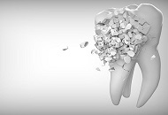 Cand este necesar un pivot dentar