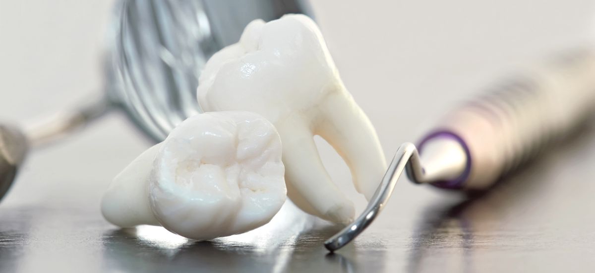 Extractii dentare in Bucuresti