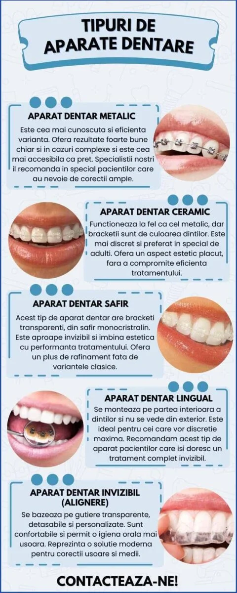 Tipuri de aparate dentare